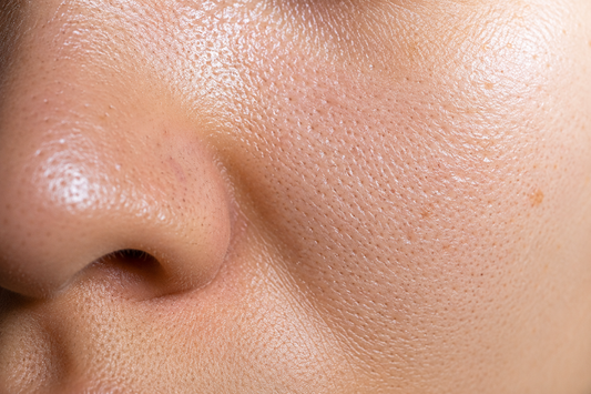 Why Do Pores Look Larger in Summer? What Does Science Say? | Nēaē Skin